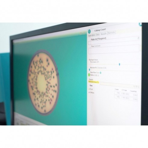 SphereFlash® - Automatic Colony Counter  SOFTWARE UPGRADES  Colonies PRO
